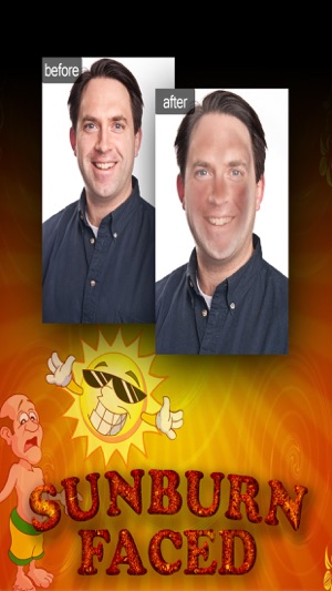 SunburnFaced - The Fake Sun Burn Photo FX Booth(圖1)-速報App