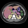 Radiology CT Viewer