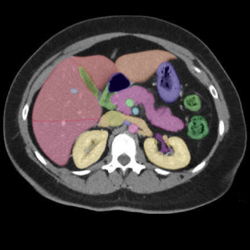 Radiology CT Viewer Icon