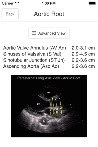 Pocket Emergency Ultrasound screenshot 4