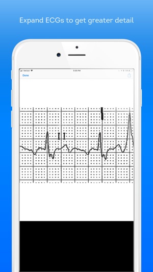 ECG Challenge(圖5)-速報App