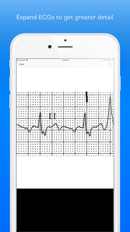 ECG Challenge screenshot-4