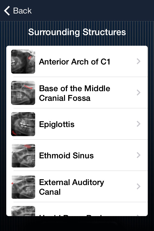 Dental Panoramic Radiology screenshot 2