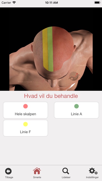 Painkillers BMS Akupunktur