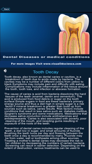 My Dental Anatomy(圖5)-速報App