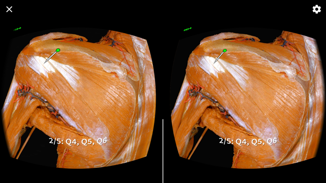 MacAnatomy VRBR(圖4)-速報App