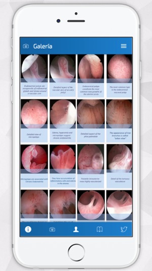 Hysteroscopy News(圖2)-速報App