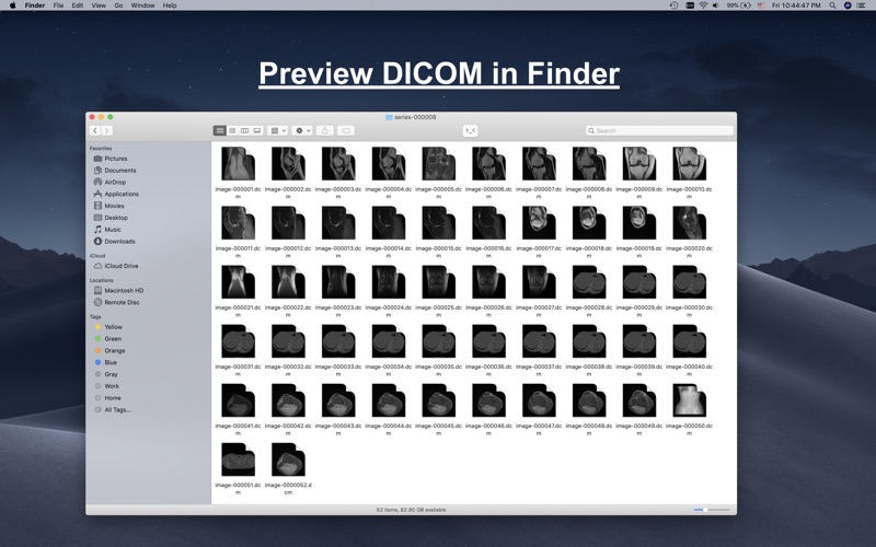 Dicom viewer os x