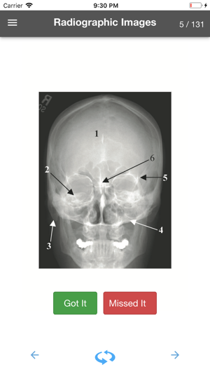 Rad Tech - Radiographic Images(圖2)-速報App