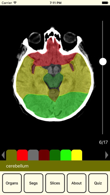 RadAnatomy