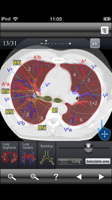 Chest CT Sectional Walker Screenshot 2