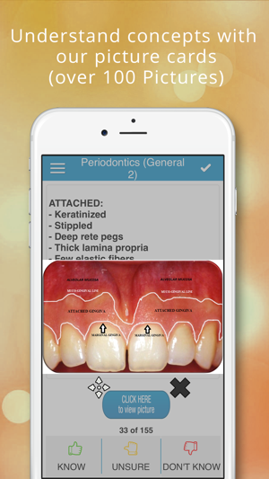 ADAT Periodontics Cram Cards(圖2)-速報App