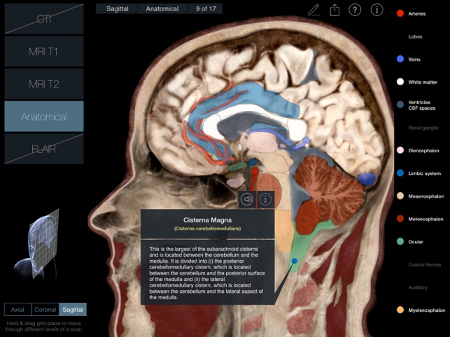 Radiology - Head(圖3)-速報App