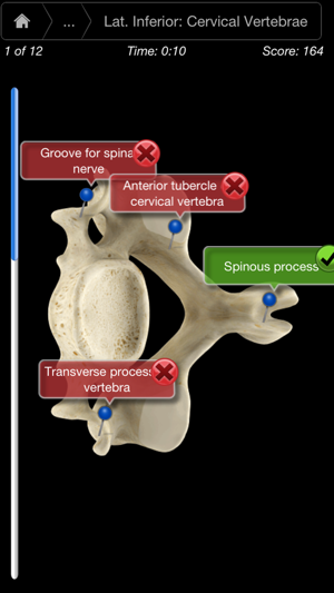 Skeleton System Pro III-iPhone(圖5)-速報App