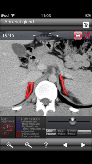 Abdominal CT Sectional Walker(圖4)-速報App