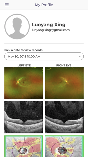 Asia Retina(圖4)-速報App