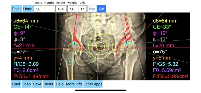 HipBiomechanicsApp(圖7)-速報App