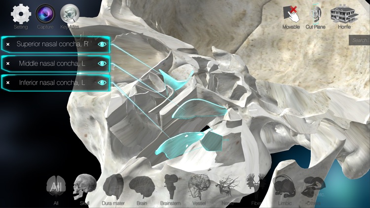 3D解剖学アトラス：iRis screenshot-3