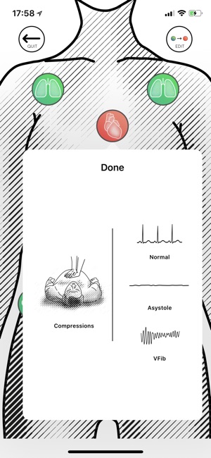 Awesome Ultrasound Simulator(圖4)-速報App