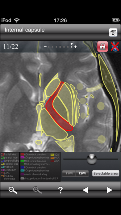 Brain MRI Sectional W... screenshot1