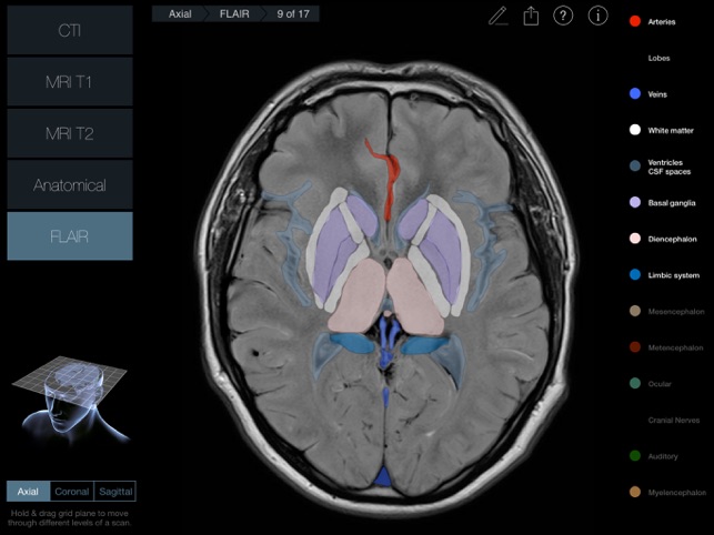 Radiology - Head