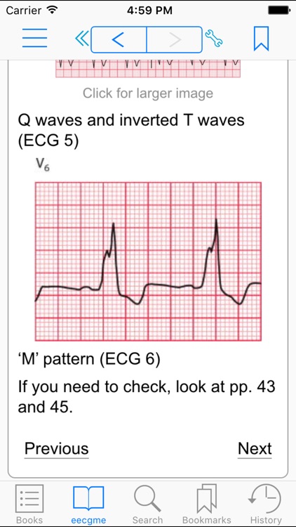 The Ecg Made Easy 8th Edition By Indextra Ab