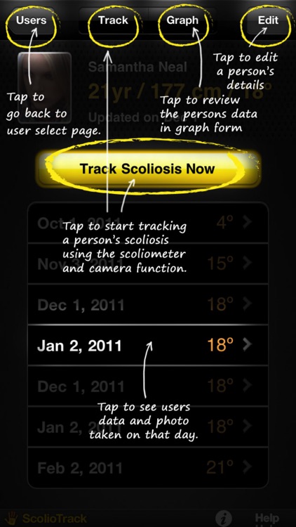 ScolioTrack
