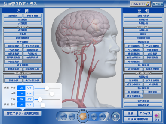 脳血管3Dアトラスのおすすめ画像2