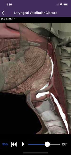 Dysphagia(圖4)-速報App