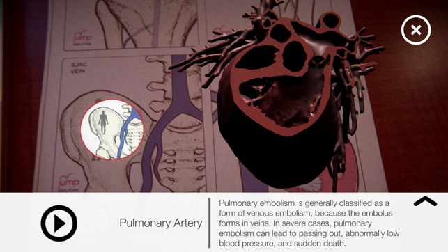 AR Anatomy by Jump Simulation