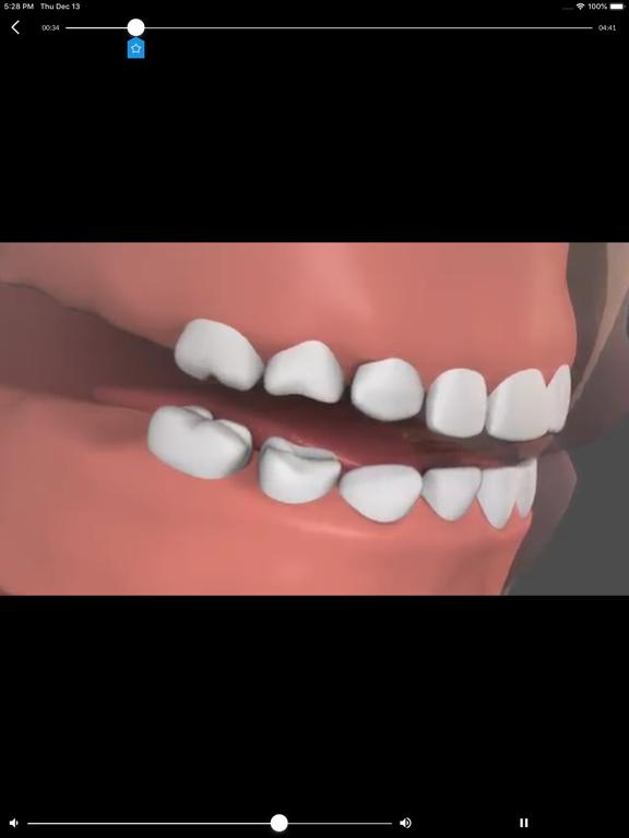 Toothflix 2.0のおすすめ画像2