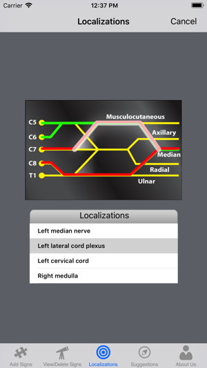 Neuro Localizer(圖5)-速報App