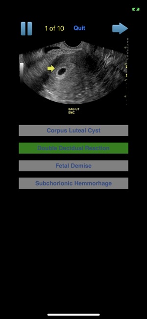 Sono Quiz OB-GYN(圖2)-速報App