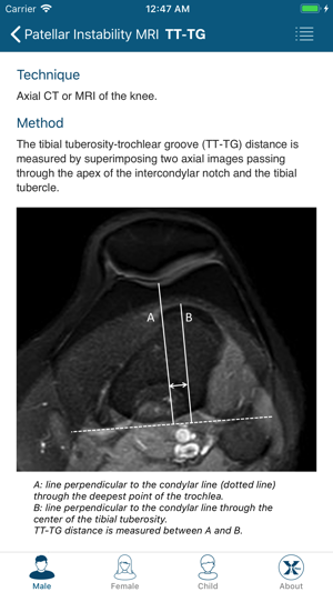 RadiologyMeasurements(圖4)-速報App