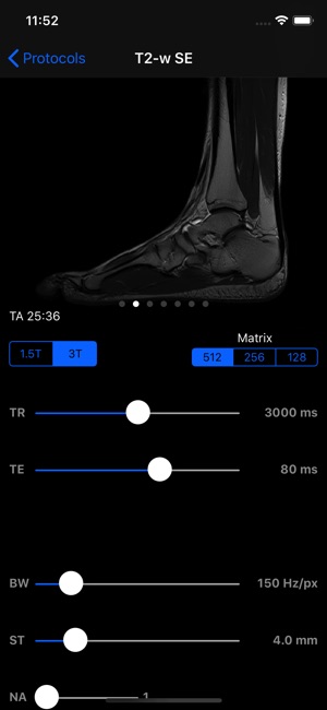 MRIcontrast(圖4)-速報App