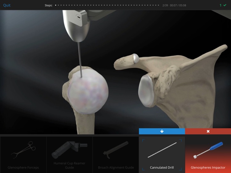Arthrex Virtual Surgery™ screenshot-3