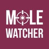 MoleWatcher