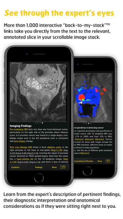 MR Imaging in Prostate Cancer screenshot-3
