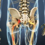 Sciatic Pain Relief