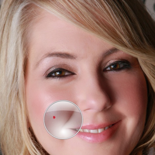 Zit Zapper Pro - Acne Remover Icon