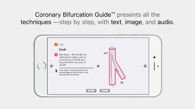 CBG Coronary Bifurcation Eng(圖3)-速報App