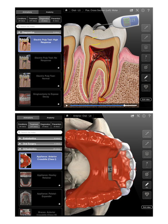 Dental Patient Education Liteのおすすめ画像5