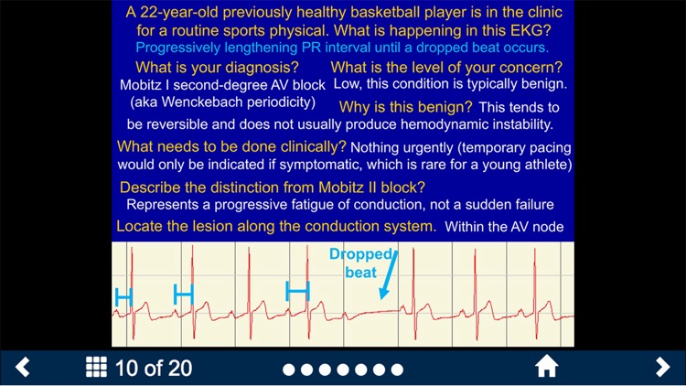 EKG - SecondLook screenshot-4