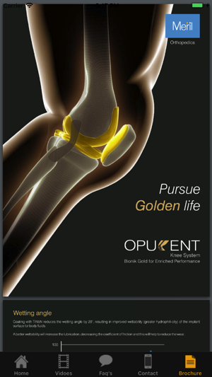 Opulent Knee(圖5)-速報App