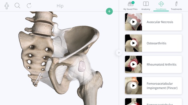 Complete Orthopedic(圖2)-速報App