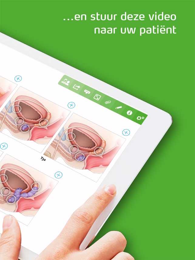 Prostaatkanker Zorgatlas(圖2)-速報App
