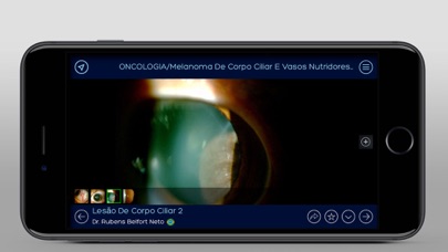 Banco de Imagens Oftalmologia screenshot 3