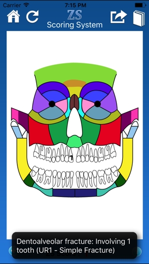 ZS Maxillofacial Trauma Score(圖4)-速報App