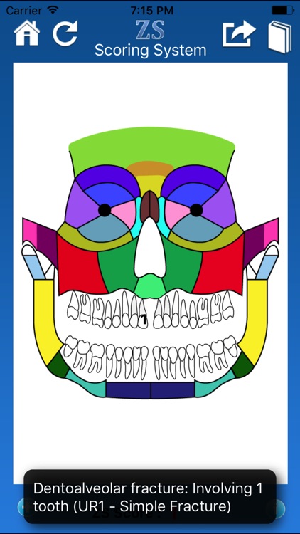 ZS Maxillofacial Trauma Score screenshot-3