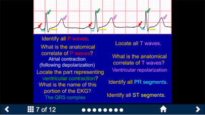 EKG - SecondLook screenshot 3